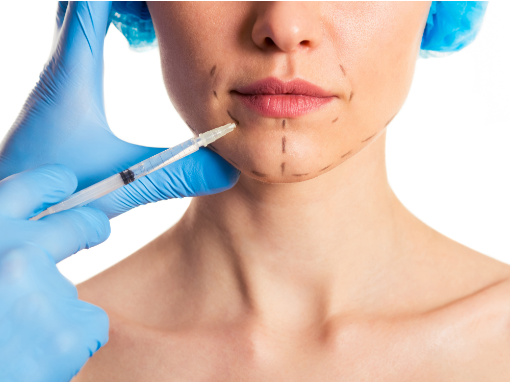 V-shape Jaw Botox Masseter Reduction Procedure Bangkok GDC