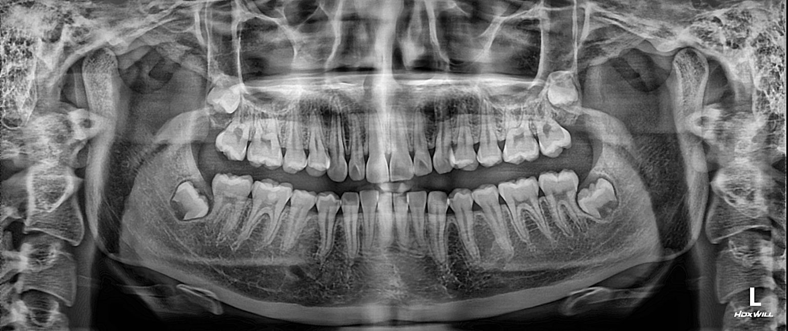 Dental CT scan & xray Best Bangkok Dental Clinic Best Dentist in