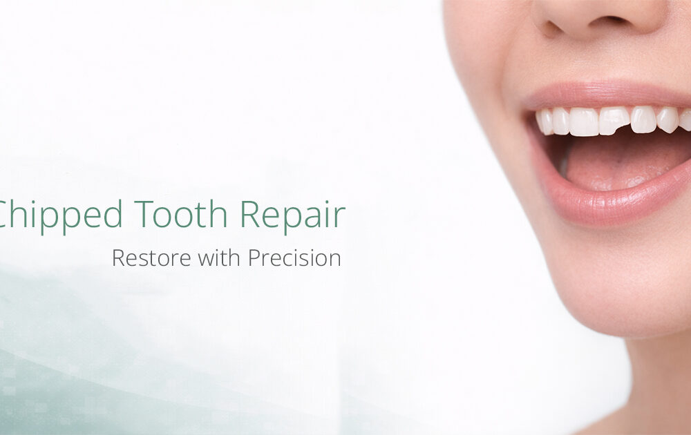 รักษาฟันบิ่นโดยทันตแพทย์เฉพาะทาง Chipped Tooth Repair and Treatment Bangkok GDC