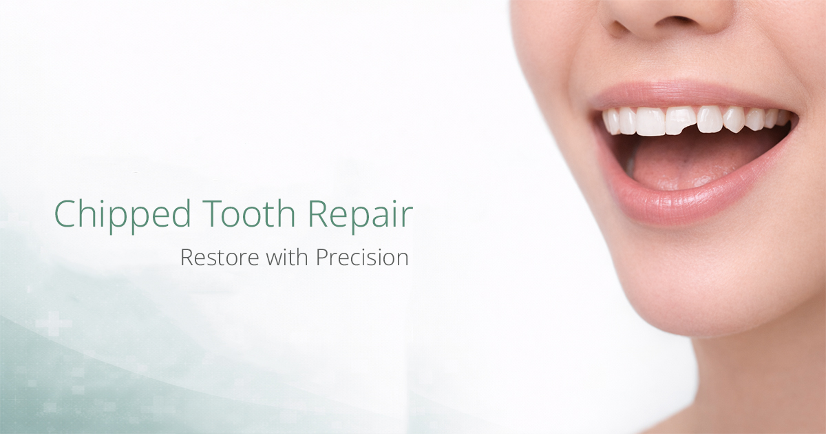 รักษาฟันบิ่นโดยทันตแพทย์เฉพาะทาง Chipped Tooth Repair and Treatment Bangkok GDC