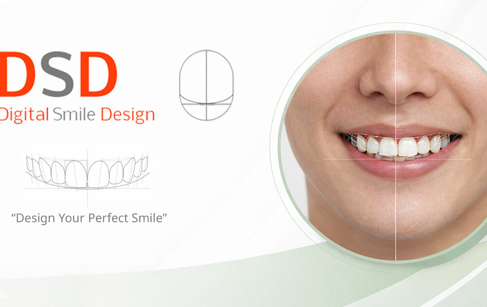 หน้าจอโปรแกรม Digital Smile Design วิเคราะห์สัดส่วนใบหน้าเพื่อออกแบบรอยยิ้ม Digital Smile Design Technology and Simulation Bangkok GDC
