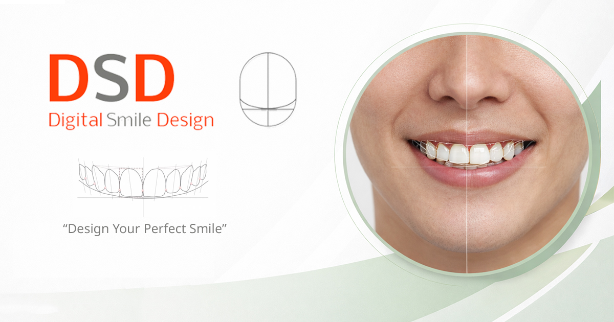 หน้าจอโปรแกรม Digital Smile Design วิเคราะห์สัดส่วนใบหน้าเพื่อออกแบบรอยยิ้ม Digital Smile Design Technology and Simulation Bangkok GDC