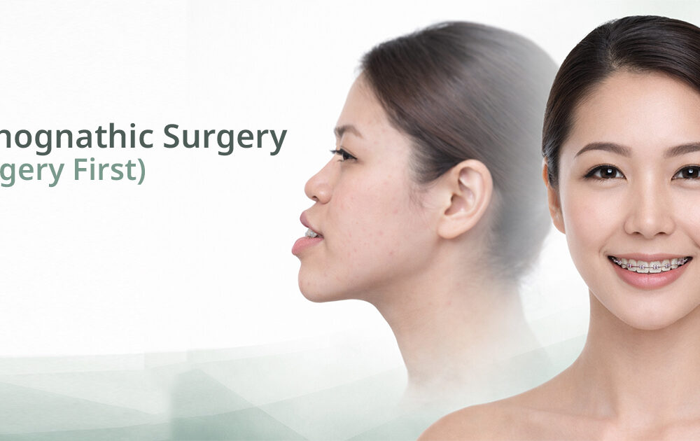รีวิวจัดฟันผ่าตัดขากรรไกร ก่อนและหลัง Global Dental Complex Orthognathic Jaw Surgery Procedure Bangkok GDC