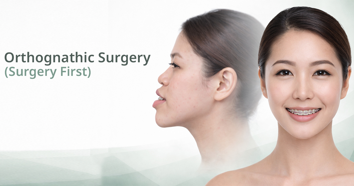 รีวิวจัดฟันผ่าตัดขากรรไกร ก่อนและหลัง Global Dental Complex Orthognathic Jaw Surgery Procedure Bangkok GDC