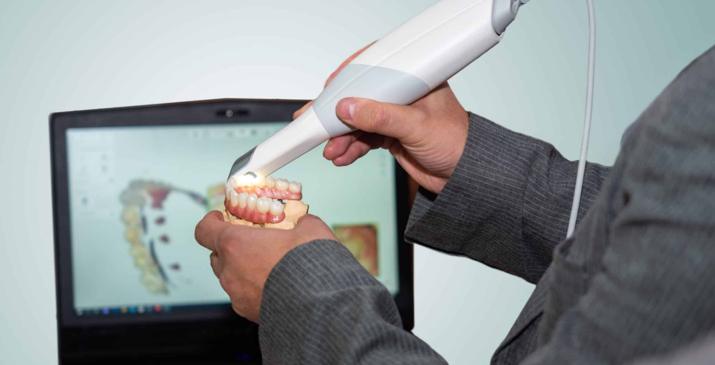 3D dental scanner scanning denture model for implant planning - รูปเครื่องมือ Digital Planning: ระบบวางแผนรากฟันเทียมดิจิทัล 3 มิติ เพื่อความแม่นยำสูง 99%