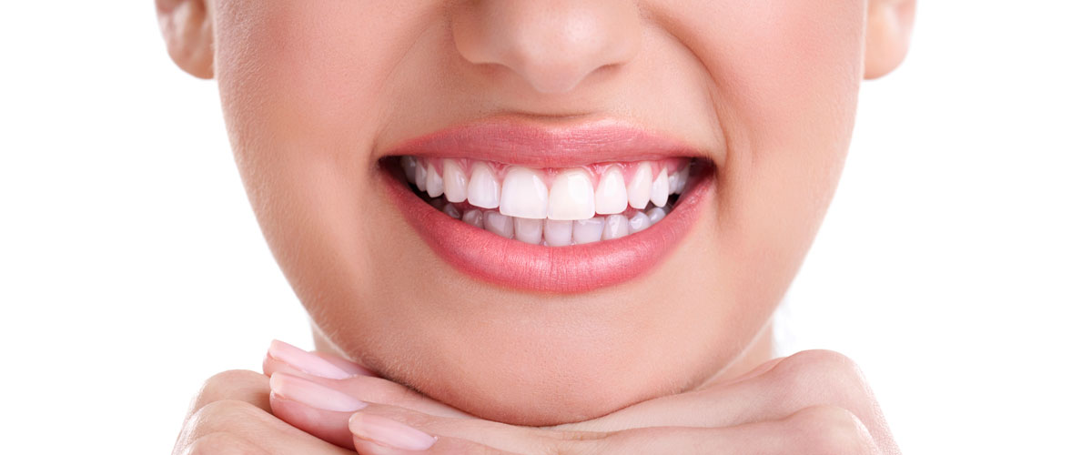 Close-up of beautiful smile with perfect teeth after dental treatment - รากฟันเทียมฟันหน้า ราคา ขั้นตอน และเทคนิคการรักษาโดยผู้เชี่ยวชาญ