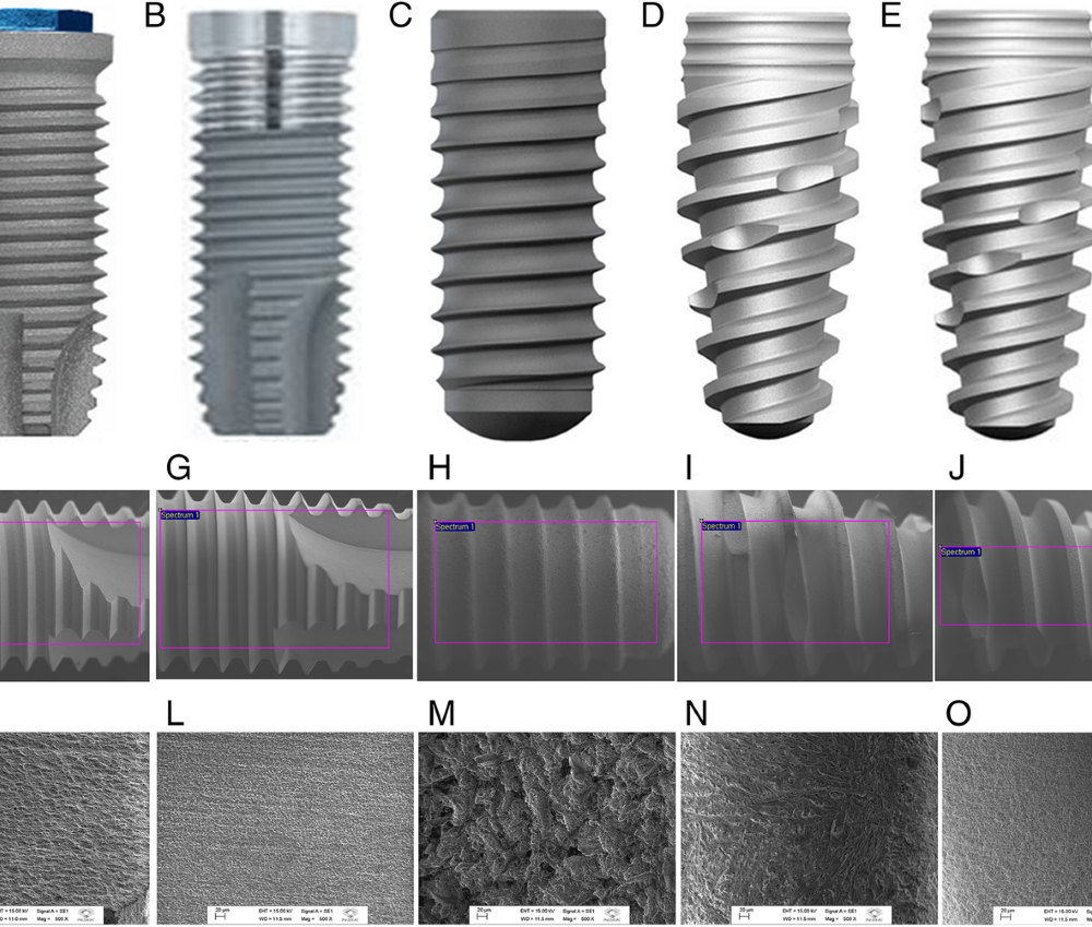 Different dental implant brands comparison and specifications