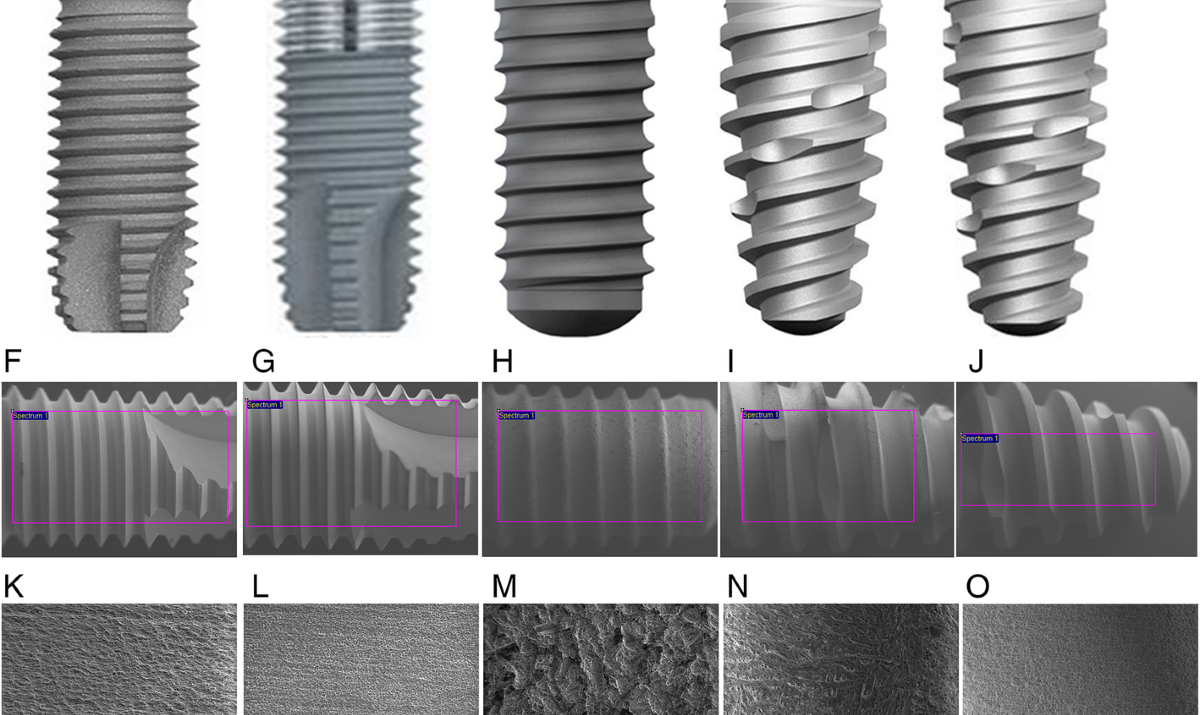Different dental implant brands comparison and specifications