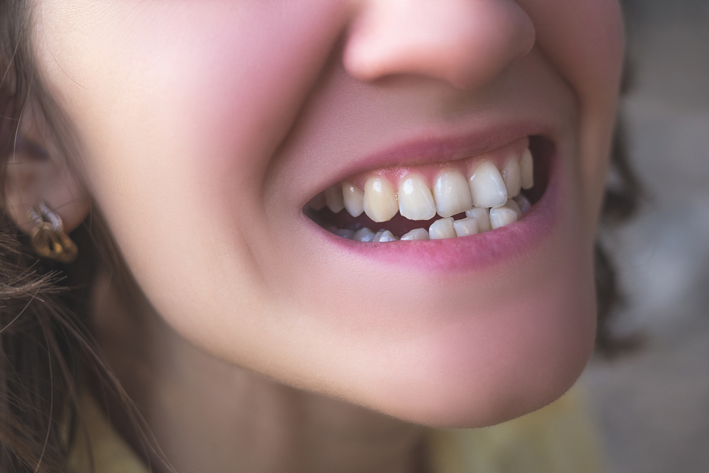 Orthodontic clinic Nonthaburi near MRT Bang Krasor Exit 1 with specialist orthodontic care.