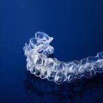 Clear Aligners รีวิว ประสบการณ์จัดฟันใส Invisalign GDC - Global Dental Complex braces: metal, Damon, and Invisalign options with specialist 3D digital planning.