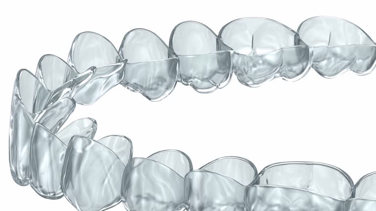 จัดฟันปรับรูปฟันให้สวยงาม ออกแบบรอยยิ้มเฉพาะบุคคล GDC - Treating severe crowding using orthodontic braces and Invisalign treatment planning at GDC.