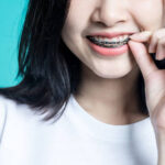 รีวิวจัดฟัน Global Dental Complex เคสก่อนและหลังการรักษา Before and after braces for protrusion: fixing overjet with metal braces and Invisalign at GDC.