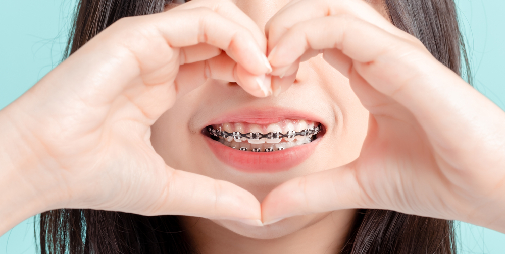 จัดฟันใสระยะเวลา Invisalign Bangkok GDC